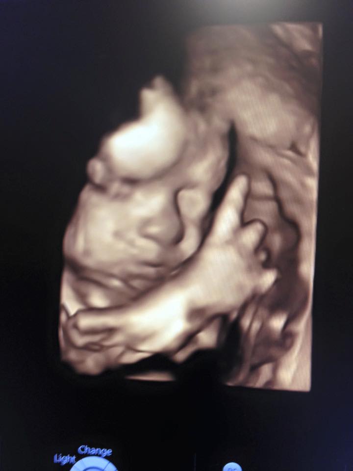 12985584_1245930205434280_6437213623694395923_n